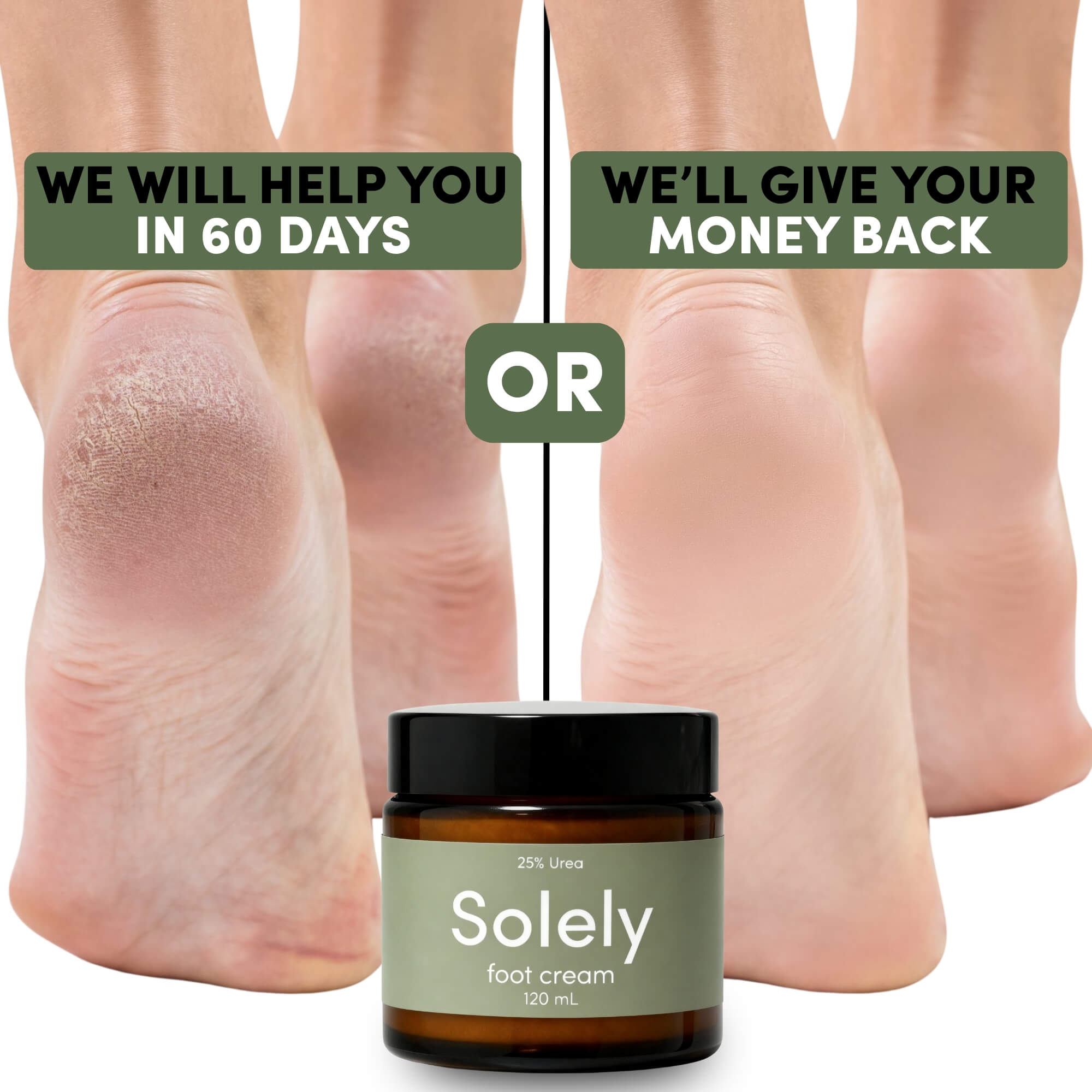 Solely 25% Urea Foot Cream