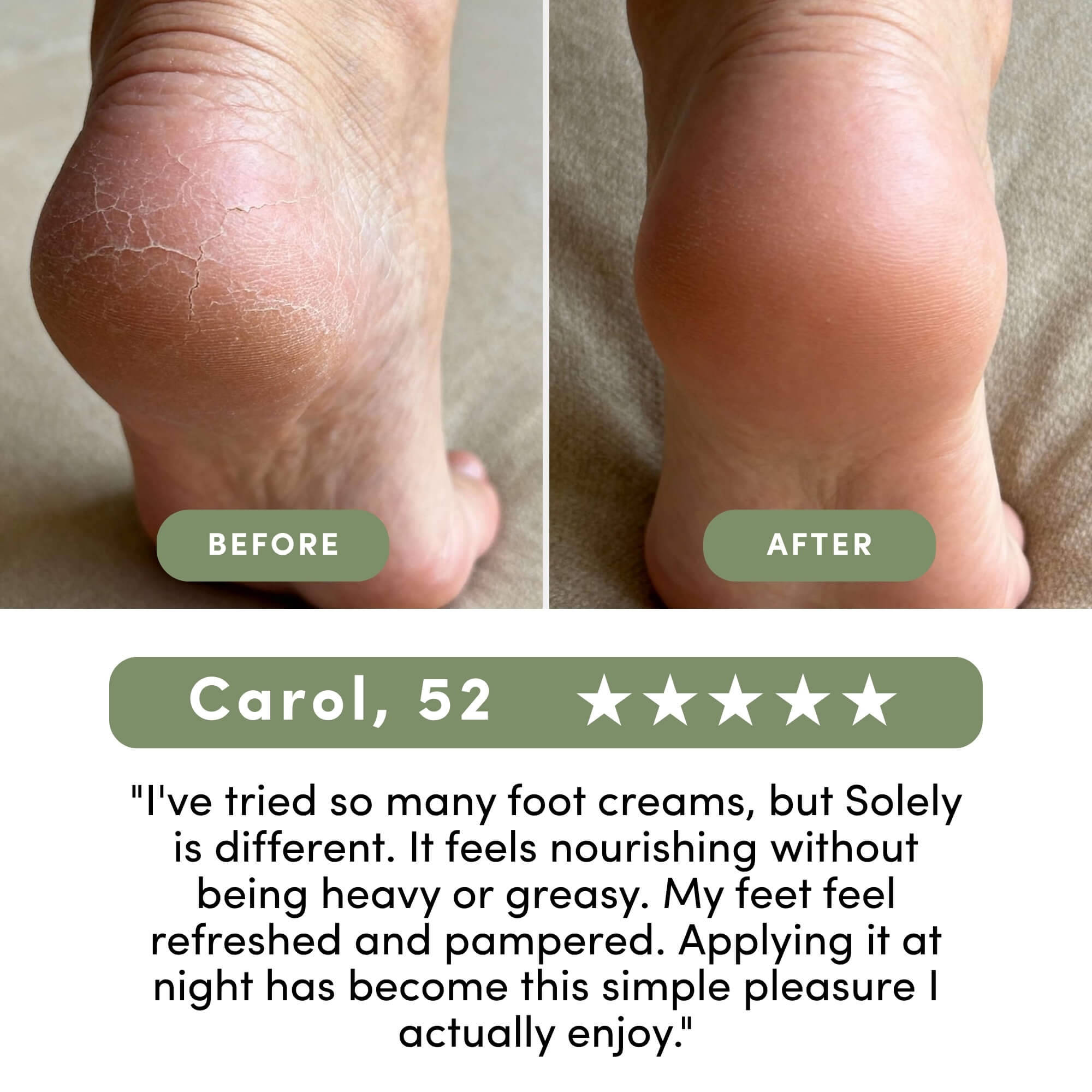 Solely 25% Urea Foot Cream